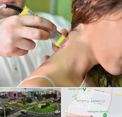 لیزر درمانی در تهرانسر