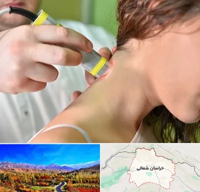 لیزر درمانی در خراسان شمالی