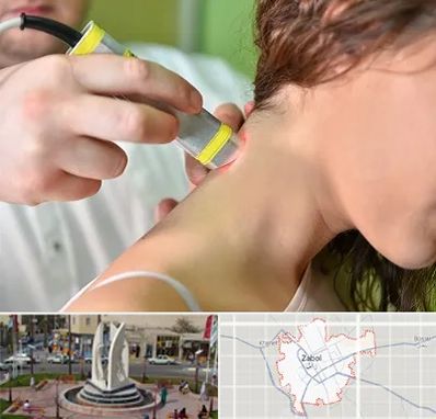 لیزر درمانی در زابل