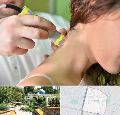 لیزر درمانی در باغمیشه تبریز