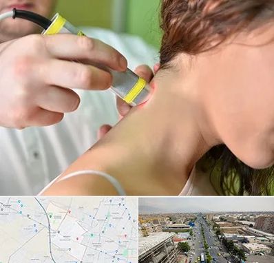 لیزر درمانی در حصارک کرج