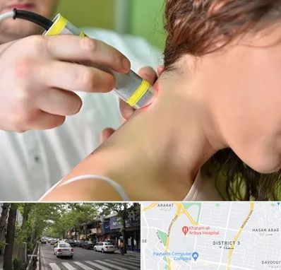 لیزر درمانی در ظفر