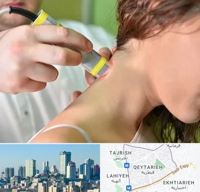 لیزر درمانی در قیطریه