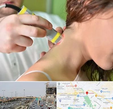 لیزر درمانی در بلوار توس مشهد