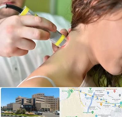 لیزر درمانی در صیاد شیرازی مشهد