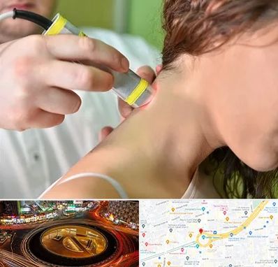 لیزر درمانی در میدان ولیعصر