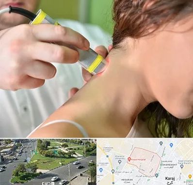 لیزر درمانی در شاهین ویلا کرج