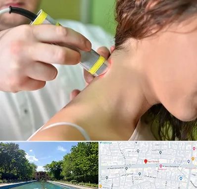 لیزر درمانی در هشت بهشت اصفهان