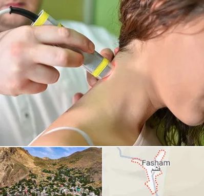 لیزر درمانی در فشم