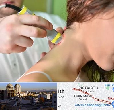 لیزر درمانی در فرمانیه