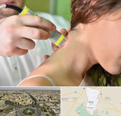 لیزر درمانی در قزوین