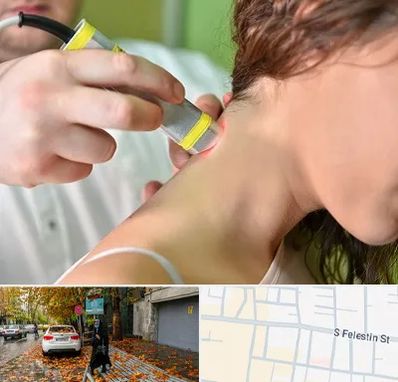 لیزر درمانی در خیابان فلسطین