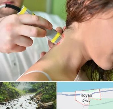 لیزر درمانی در رویان