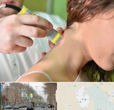 لیزر درمانی در نظرآباد کرج