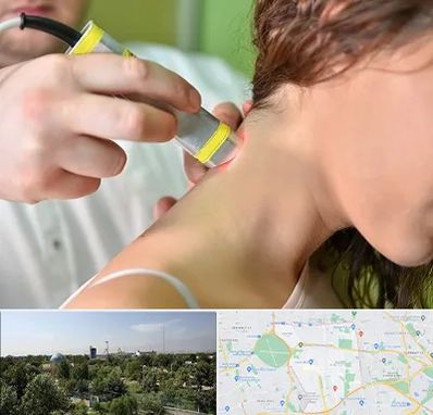 لیزر درمانی در منطقه 16 تهران