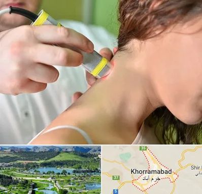 لیزر درمانی در خرم آباد