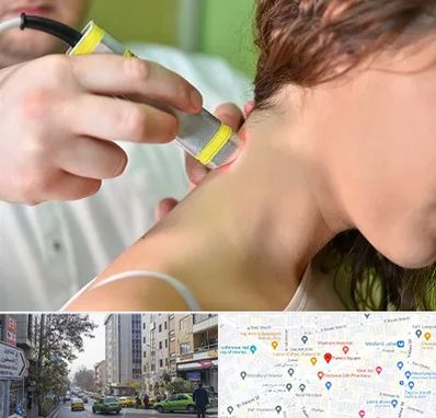 لیزر درمانی در فاطمی