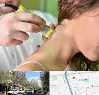 لیزر درمانی در کوی فیروز تبریز