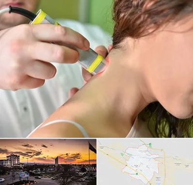 لیزر درمانی در قوچان