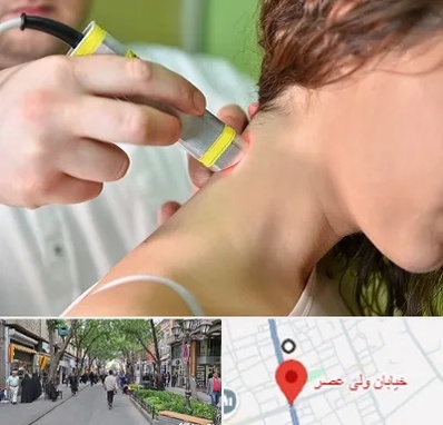 لیزر درمانی در ولیعصر شهریار