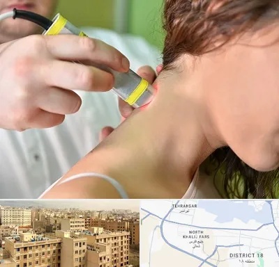 لیزر درمانی در جنوب غرب تهران