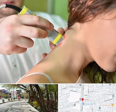 لیزر درمانی در خیابان توحید اصفهان