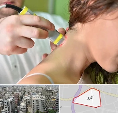 لیزر درمانی در آذری