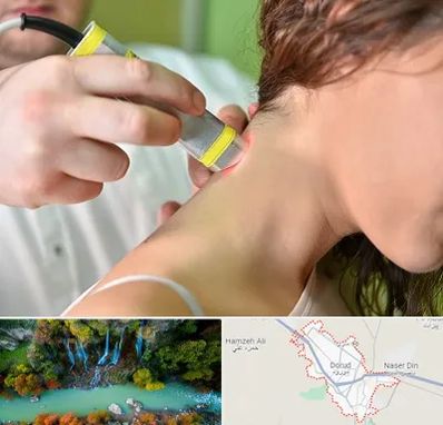 لیزر درمانی در دورود