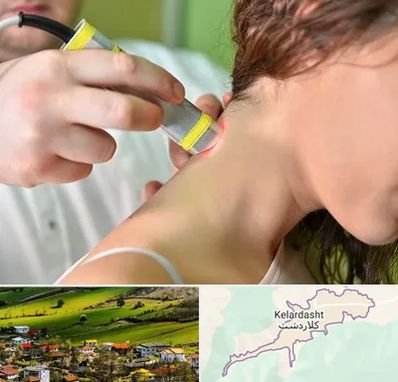 لیزر درمانی در کلاردشت