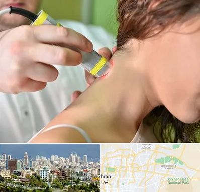 لیزر درمانی در شرق تهران