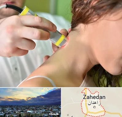 لیزر درمانی در زاهدان