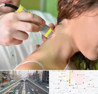 لیزر درمانی در توحید