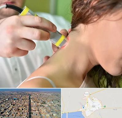 لیزر درمانی در بندر ماهشهر