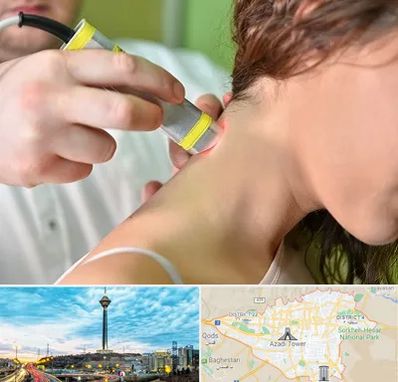 لیزر درمانی در تهران