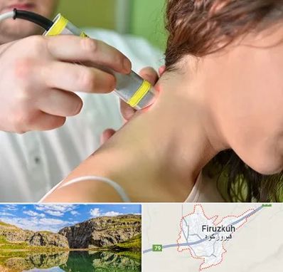لیزر درمانی در فیروزکوه
