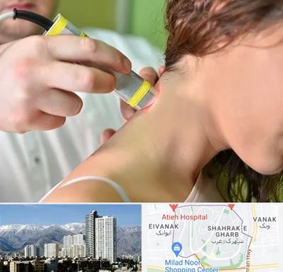 لیزر درمانی در شهرک غرب