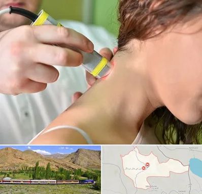 لیزر درمانی در خاش