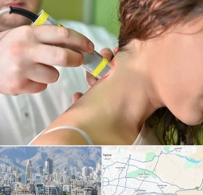 لیزر درمانی در شمال شرق تهران