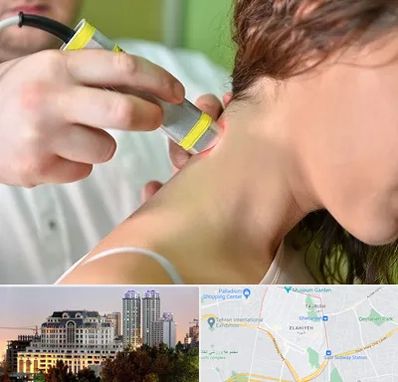 لیزر درمانی در فرشته