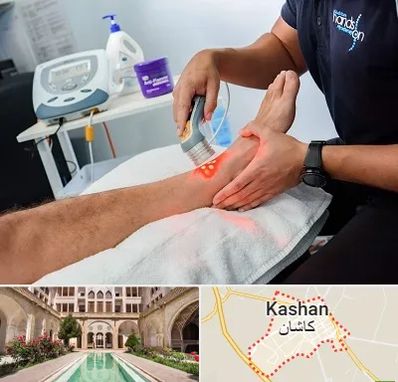 لیزر تراپی در کاشان