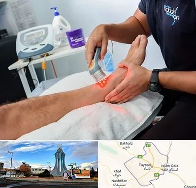 لیزر تراپی در تایباد