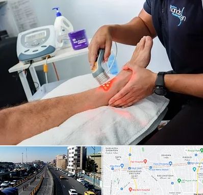 لیزر تراپی در پیروزی