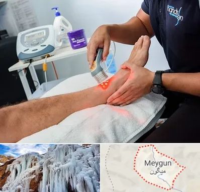 لیزر تراپی در میگون