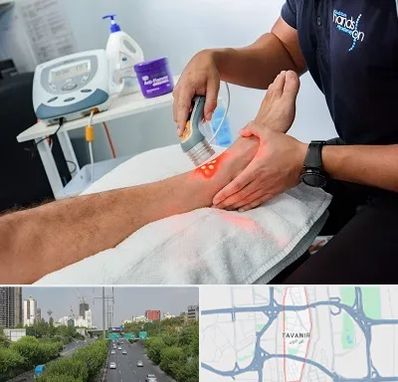 لیزر تراپی در توانیر