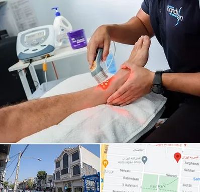 لیزر تراپی در افسریه