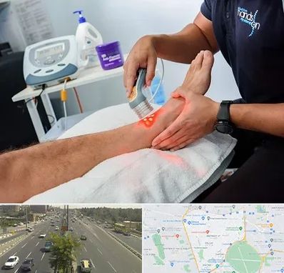 لیزر تراپی در منطقه 17 تهران