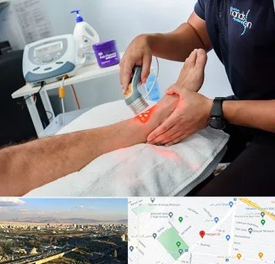 لیزر تراپی در هنگام