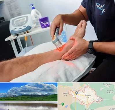 لیزر تراپی در مرند