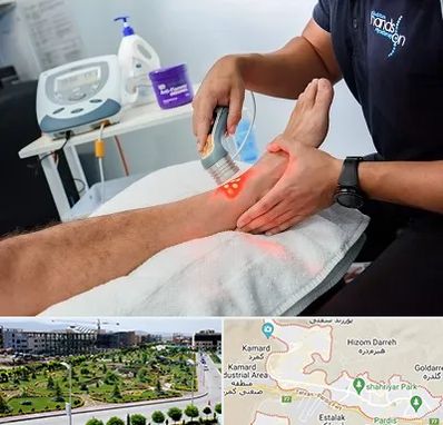 لیزر تراپی در پردیس