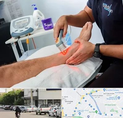 لیزر تراپی در قدوسی شرقی شیراز